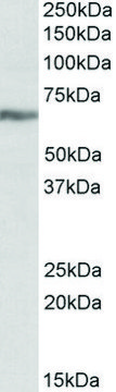 Anti-IGF2BP1 antibody produced in goat affinity isolated antibody, buffered aqueous solution