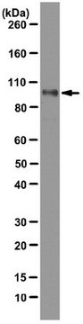 Anti-PRDM1 (BLIMP-1) Antibody, clone 6D3 clone 6D3, from rat