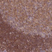 Anti-ARHGAP17 antibody produced in rabbit Prestige Antibodies® Powered by Atlas Antibodies, affinity isolated antibody, buffered aqueous glycerol solution