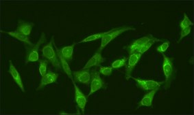 Anti-RanGAP1 (N-terminal) antibody produced in rabbit affinity isolated antibody, buffered aqueous solution, ~2 mg/mL