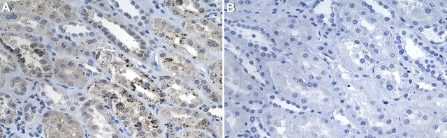 Anti-Caspase-9 Antibody, clone 1G22 ZooMAb&#174; Rabbit Monoclonal recombinant, expressed in HEK 293 cells