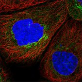 Anti-NOX1 antibody produced in rabbit Prestige Antibodies® Powered by Atlas Antibodies, affinity isolated antibody, buffered aqueous glycerol solution