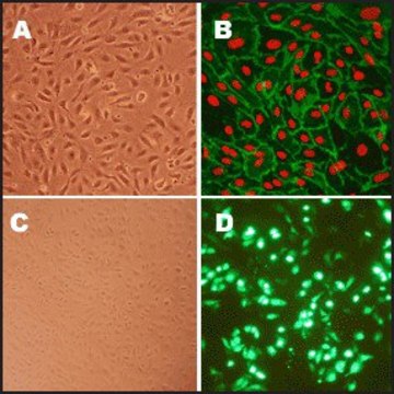 Human Aortic Endothelial Cells: HAOEC, adult