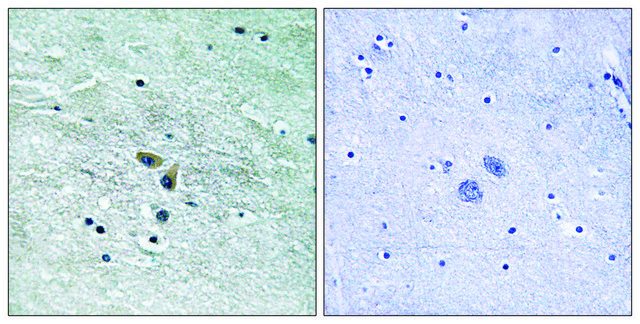 Anti-MAP3K8 antibody produced in rabbit affinity isolated antibody