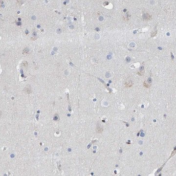 Anti-MMP16 antibody produced in rabbit Prestige Antibodies&#174; Powered by Atlas Antibodies, affinity isolated antibody, buffered aqueous glycerol solution