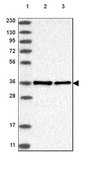 Anti-NIFK antibody produced in rabbit Prestige Antibodies® Powered by Atlas Antibodies, affinity isolated antibody, buffered aqueous glycerol solution