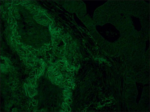 Monoclonal Anti-HLA Class I Antigen&#8722;FITC antibody produced in mouse clone W6/32, purified immunoglobulin, buffered aqueous solution