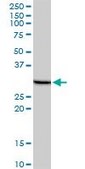 Monoclonal Anti-PHOSPHO1, (C-terminal) antibody produced in mouse clone 1A11, purified immunoglobulin, buffered aqueous solution
