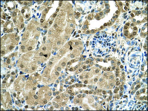 Anti-TBX15 antibody produced in rabbit IgG fraction of antiserum