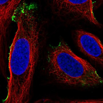 Anti-Mst1 Antibody Produced In Rabbit Prestige Antibodies&#174; Powered by Atlas Antibodies, affinity isolated antibody, buffered aqueous glycerol solution