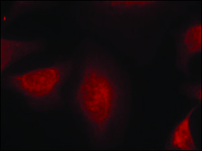 Anti-MDM2 (Ab-166) antibody produced in rabbit affinity isolated antibody