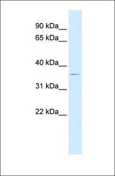 Anti-TRIB2 antibody produced in rabbit affinity isolated antibody