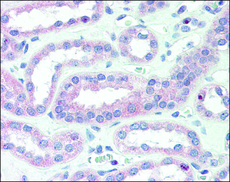 Anti-CRLF2 antibody produced in rabbit affinity isolated antibody