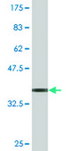 Monoclonal Anti-FZD4 antibody produced in mouse clone 3G7, purified immunoglobulin, buffered aqueous solution