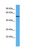Anti-DCT antibody produced in rabbit affinity isolated antibody