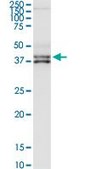 Anti-CFHR1 antibody produced in rabbit purified immunoglobulin, buffered aqueous solution