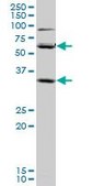 Monoclonal Anti-SLC36A2 antibody produced in mouse clone 2H3, purified immunoglobulin, buffered aqueous solution