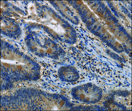 Anti-ITPR2 antibody produced in rabbit affinity isolated antibody