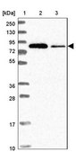 Anti-EIF4B antibody produced in rabbit Prestige Antibodies® Powered by Atlas Antibodies, affinity isolated antibody, buffered aqueous glycerol solution