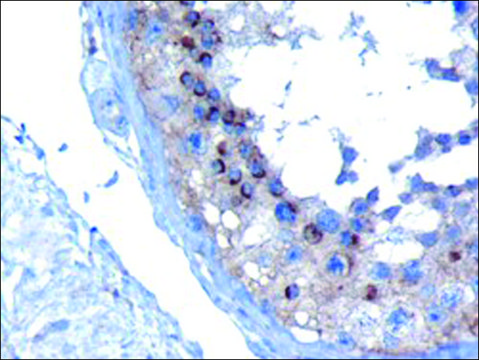 Anti-VPS28 antibody produced in goat affinity isolated antibody, buffered aqueous solution