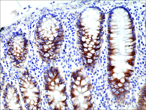 Anti-CD71 antibody, Rabbit monoclonal recombinant, expressed in HEK 293 cells, clone RM384, purified immunoglobulin