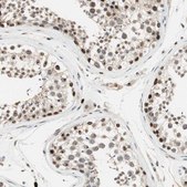 Anti-ETV4 antibody produced in rabbit Prestige Antibodies® Powered by Atlas Antibodies, affinity isolated antibody, buffered aqueous glycerol solution