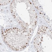 Anti-SUPT5H antibody produced in rabbit Prestige Antibodies® Powered by Atlas Antibodies, affinity isolated antibody, buffered aqueous glycerol solution