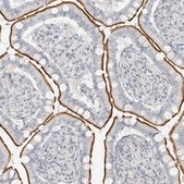 Anti-OSBPL7 antibody produced in rabbit Prestige Antibodies® Powered by Atlas Antibodies, affinity isolated antibody, buffered aqueous glycerol solution