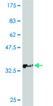 Monoclonal Anti-ATP7B antibody produced in mouse clone 3E10, purified immunoglobulin, buffered aqueous solution