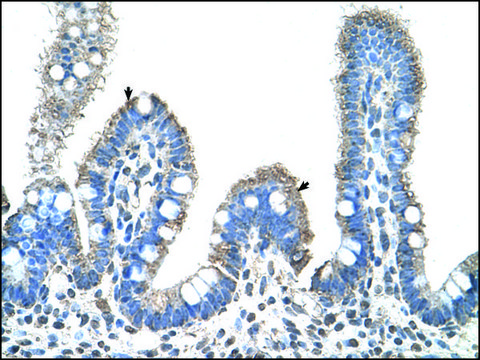 Anti-SLC22A1 (AB2) antibody produced in rabbit IgG fraction of antiserum