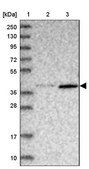 Anti-ABLIM1 antibody produced in rabbit Prestige Antibodies® Powered by Atlas Antibodies, affinity isolated antibody, buffered aqueous glycerol solution