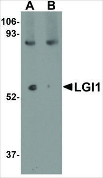 Anti-LGI1 (ab2) antibody produced in rabbit affinity isolated antibody, buffered aqueous solution