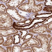 Anti-MT-CO2 antibody produced in rabbit Prestige Antibodies® Powered by Atlas Antibodies, affinity isolated antibody, buffered aqueous glycerol solution