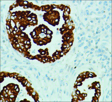 Anti-RRM1 antibody, Rabbit monoclonal recombinant, expressed in proprietary host, clone SP167, affinity isolated antibody