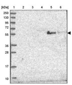 Anti-ST3GAL5 antibody produced in rabbit Prestige Antibodies® Powered by Atlas Antibodies, affinity isolated antibody, buffered aqueous glycerol solution