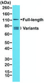 Anti-AR (n-terminal) antibody, Rabbit monoclonal recombinant, expressed in HEK 293 cells, clone RM254, purified immunoglobulin