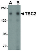 Anti-TSC2 (ab1) antibody produced in rabbit affinity isolated antibody, buffered aqueous solution