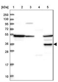 Anti-SDS antibody produced in rabbit Prestige Antibodies® Powered by Atlas Antibodies, affinity isolated antibody, buffered aqueous glycerol solution