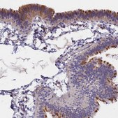 Anti-TMEM138 antibody produced in rabbit Prestige Antibodies® Powered by Atlas Antibodies, affinity isolated antibody, buffered aqueous glycerol solution