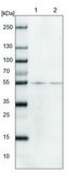 Anti-TUBB8 antibody produced in rabbit Prestige Antibodies® Powered by Atlas Antibodies, affinity isolated antibody, buffered aqueous glycerol solution