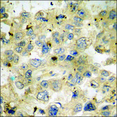 Anti-phospho-FAK (pTyr397) antibody produced in rabbit affinity isolated antibody