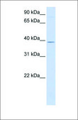 Anti-GTPBP10 (ab1) antibody produced in rabbit affinity isolated antibody