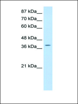 Anti-MyST4 antibody produced in rabbit affinity isolated antibody