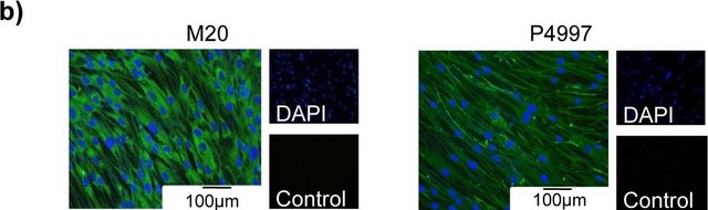 Anti-Potassium Channel KCa3.1 (Intermediate-conductance Ca2+-activated Potassium Channel 4) antibody produced in rabbit affinity isolated antibody, lyophilized powder