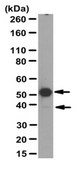 Anti-C-X-C chemokine receptor type 5 (CXCR5) Antibody from rabbit, purified by affinity chromatography