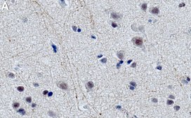 Anti-Drosha Antibody, clone 1B19 ZooMAb® Rabbit Monoclonal recombinant, expressed in HEK 293 cells