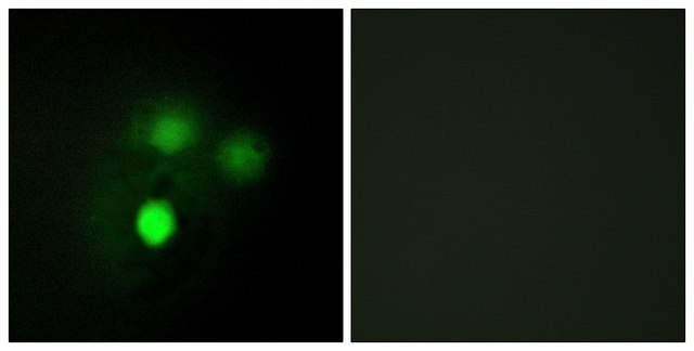 Anti-KNTC2 antibody produced in rabbit affinity isolated antibody