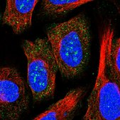 Anti-ZCCHC2 antibody produced in rabbit Prestige Antibodies® Powered by Atlas Antibodies, affinity isolated antibody, buffered aqueous glycerol solution