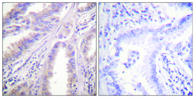 Anti-KIF11 antibody produced in rabbit affinity isolated antibody