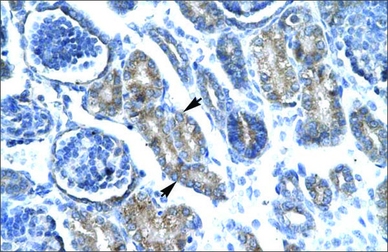 Anti-FOXF1 (AB2) antibody produced in rabbit IgG fraction of antiserum